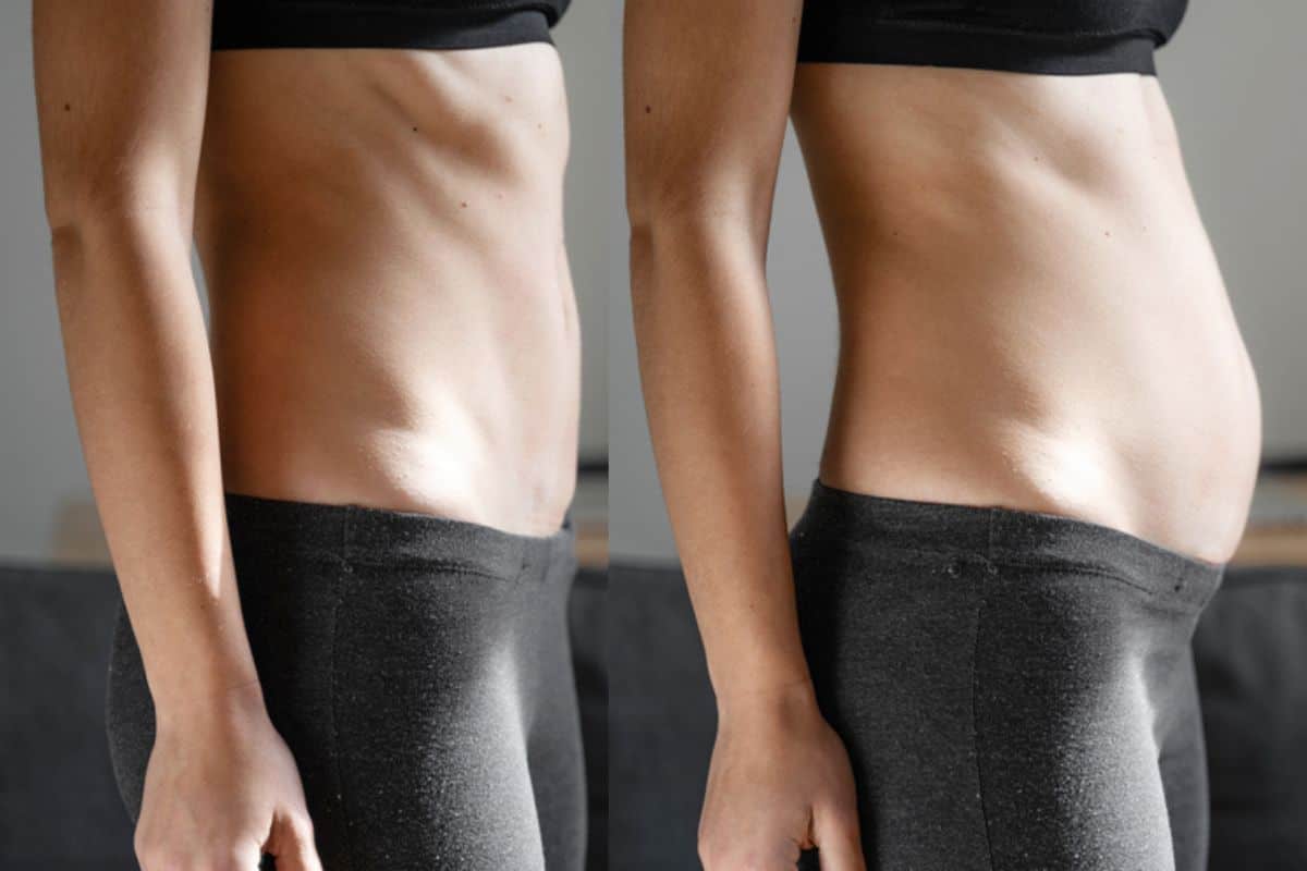 How long does diastasis recti take to improve Abingdon-on-Thames?
