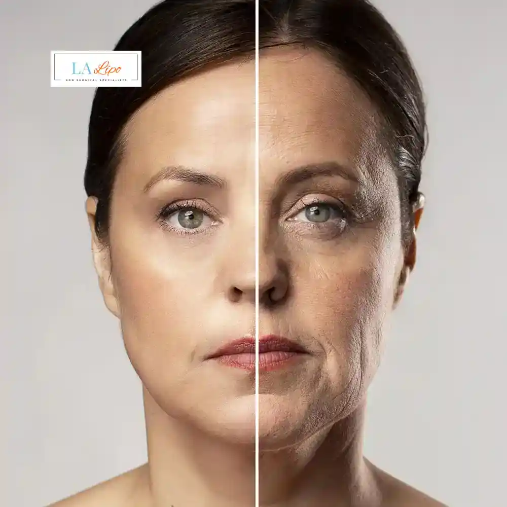 How Can You Tell If Non-Surgical Skin Tightening Is Right for You Abingdon-on-Thames?