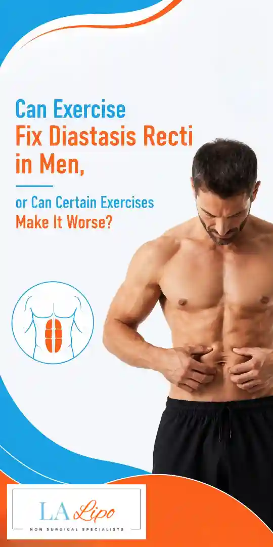 Can Exercise Fix Diastasis Recti in Men, or Can Certain Exercises Make It Worse Abingdon-on-Thames?